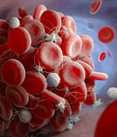 Antiphospholipid Antibody Syndrome Awareness Month