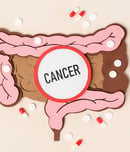 bowel cancer awareness month