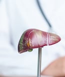 cholangiocarcinoma awareness month