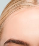Big Forehead Day