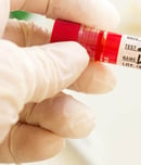 hepatitis testing day
