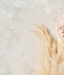 international albinism day