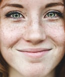 love your freckles day