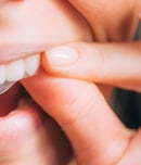 National Align Your Teeth Day