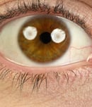 National Mechanical Dry Eye Day