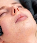 national peel day