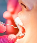 national pinhole gum rejuvenation month