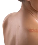 scar appreciation day