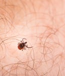 tick bite prevention week