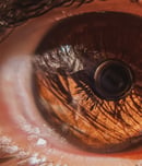 world glaucoma day