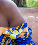 World Neglected Tropical Disease (NTD) Day