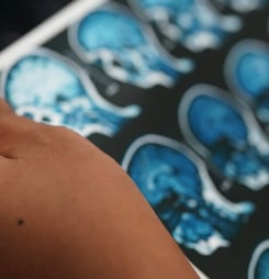 brain injury awareness day