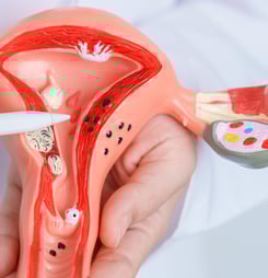 endometriosis awareness day