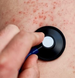 international mastocytosis mast cekk dusease awareness day