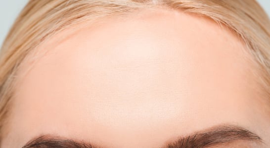 Big Forehead Day