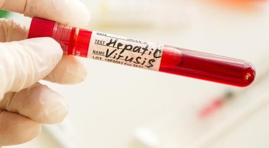 Hepatitis Testing Day