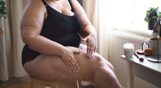 Lipedema Awareness Month
