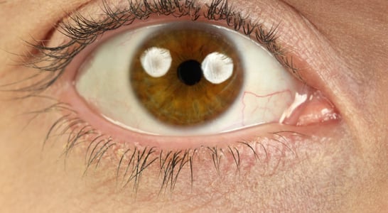 National Mechanical Dry Eye Day