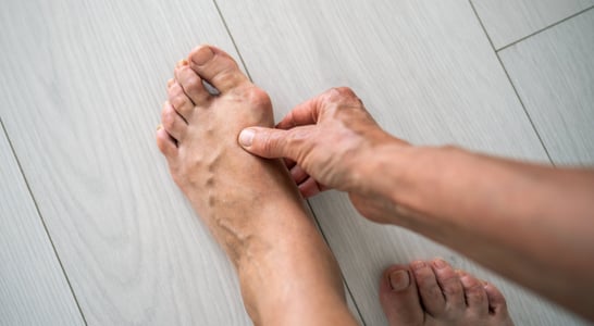 National Bunion Day