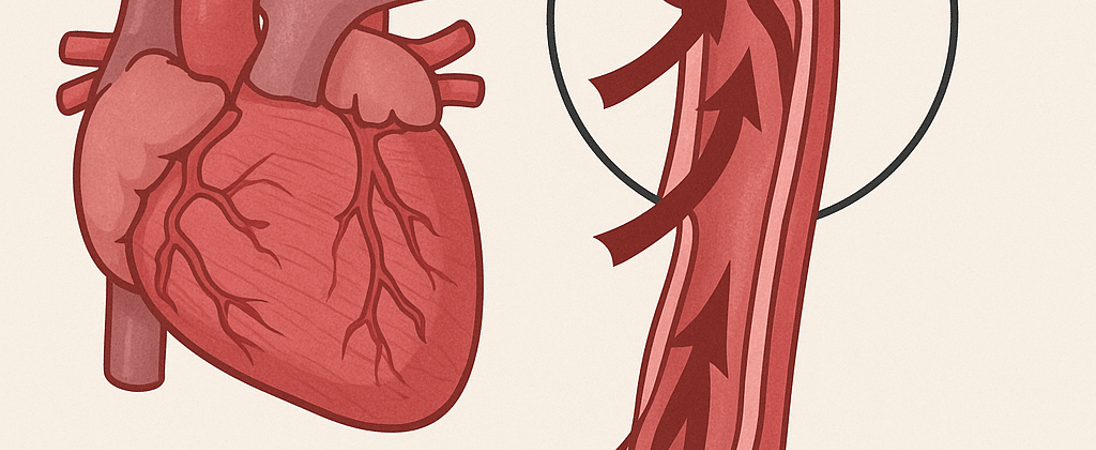 Aortic Dissection Awareness Day