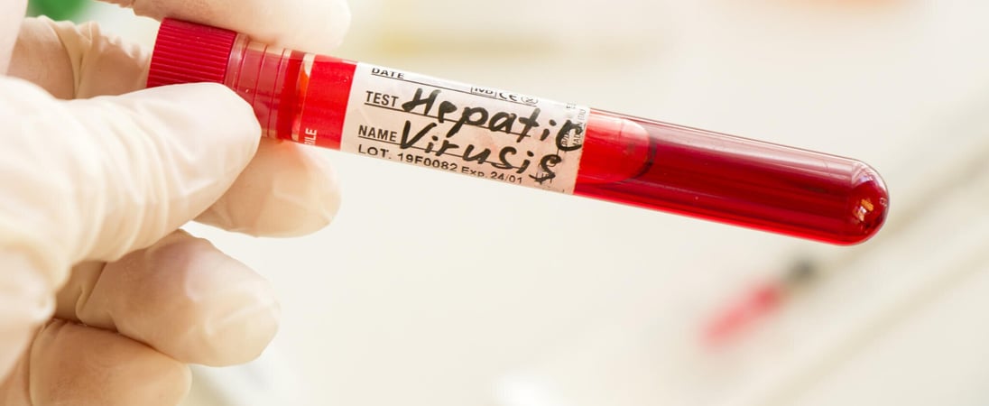 Hepatitis Testing Day