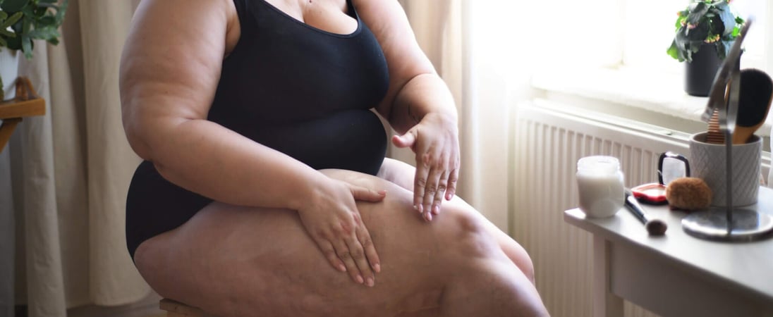 Lipedema Awareness Month