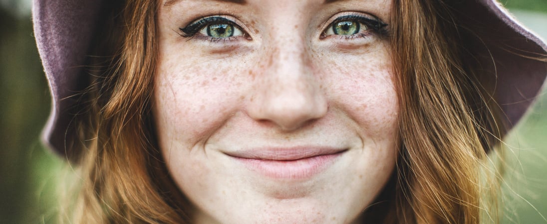 Love Your Freckles Day