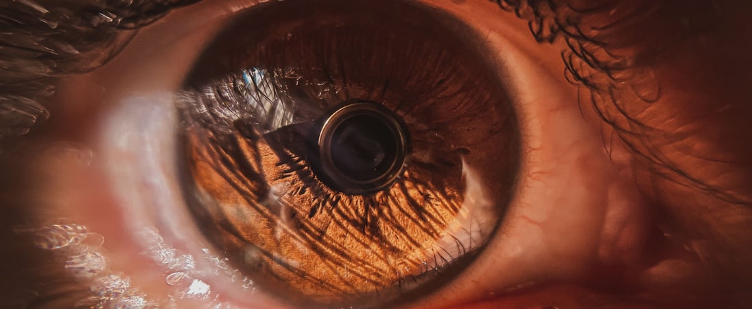 World Glaucoma Day