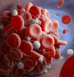 Antiphospholipid Antibody Syndrome Awareness Month