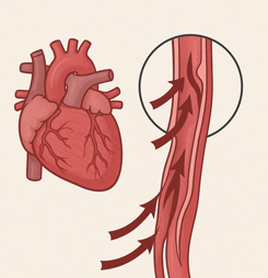 aortic dissection awareness day