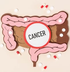 bowel cancer awareness month