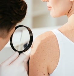 Cancer from the Sun Month