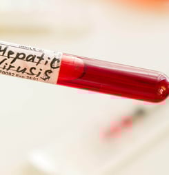 hepatitis testing day