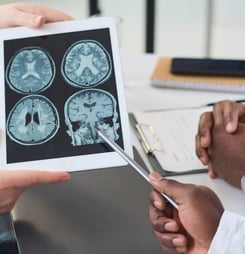 huntington's disease