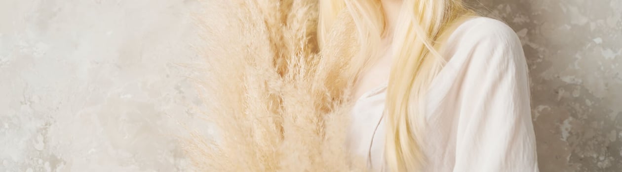 international albinism day