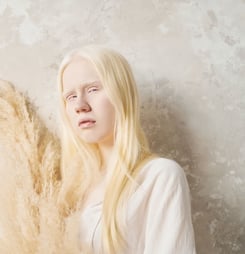 international albinism day