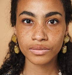 international skin pigmentation day