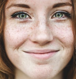 love your freckles day