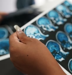 national brain injury awareness month