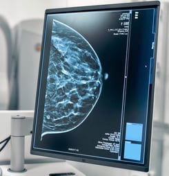 national got checked day