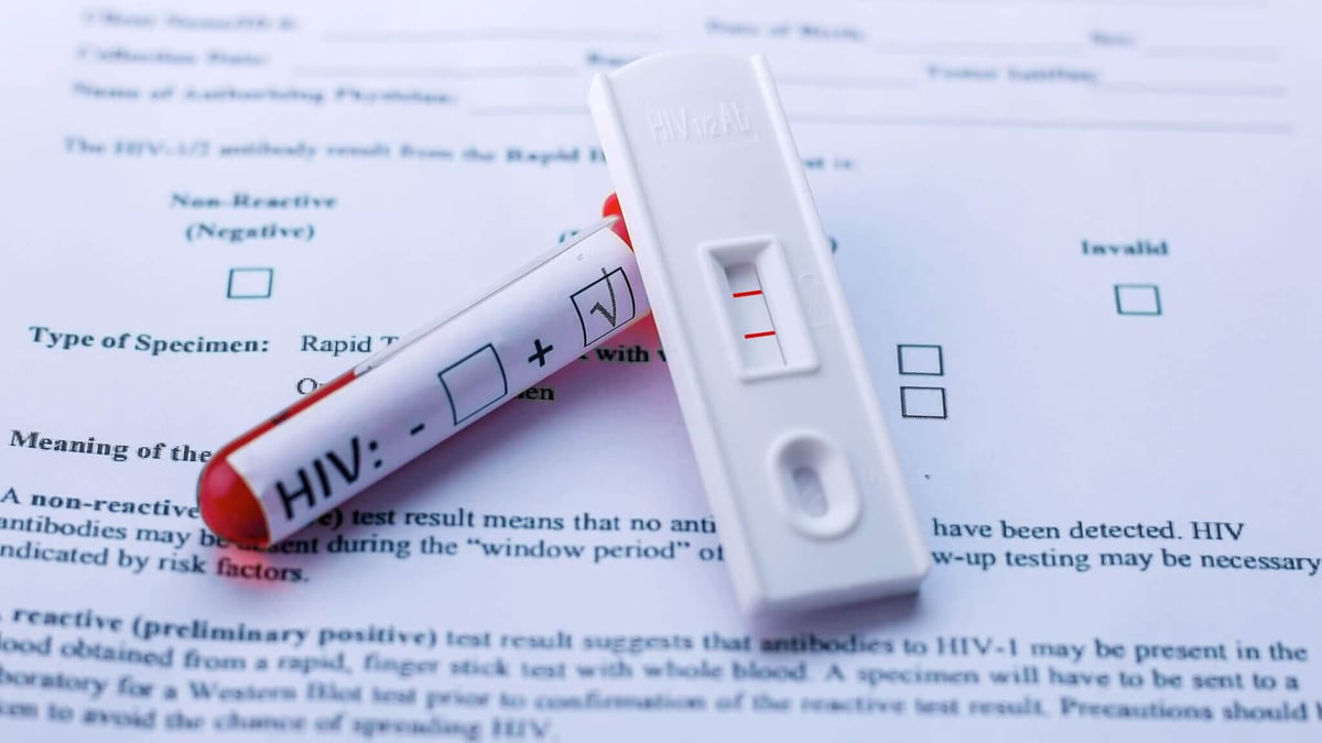 National HIV Testing Day | Days Of The Year