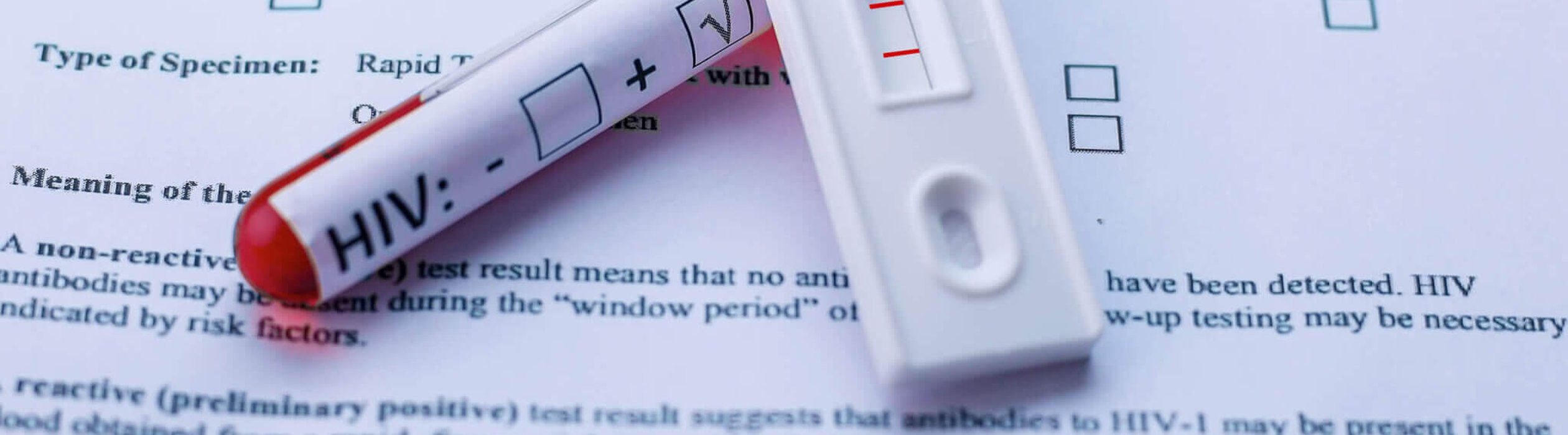 National HIV Testing Day | Days Of The Year