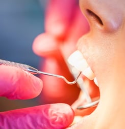 national pinhole gum rejuvenation month