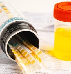 national surprise drug test day