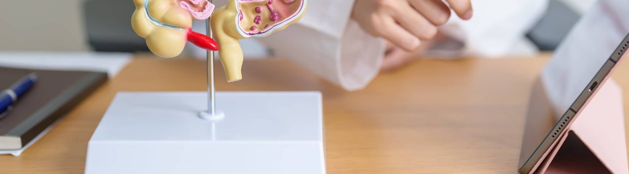 step up for 30 for bowel cancer month