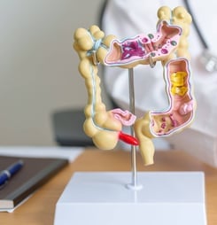 step up for 30 for bowel cancer month