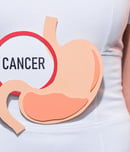 Stomach Cancer Awareness Day