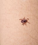 world chagas disease